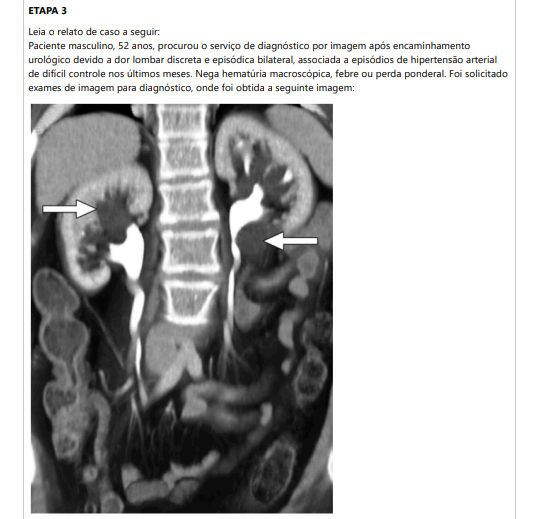 ETAPA 3 Leia o relato de caso a seguir: Paciente masculino, 52 anos, procurou o serviço de diagnóstico por imagem após encaminhamento urológico devido a dor lombar discreta e episódica bilateral, associada a episódios de hipertensão arterial de difícil controle nos últimos meses. Nega hematúria macroscópica, febre ou perda ponderal. Foi solicitadoexames de imagem para diagnóstico, onde foi obtida a seguinte imagem: Figura 1: O’CONNOR, Owen J.; MAHER, Michael M. CT urography. American Journal of Roentgenology, v. 195, n. 5, p. W320–W324, nov. 2010. DOI: 10.2214/AJR.10.4198. Disponível em: https://ajronline.org/doi/10.2214/AJR.10.4198 3.1) CITE o exame de imagem realizado e o plano anatômico da Figura 1. 3.2) MENCIONE o contraste utilizado e a via de administração. 3.3) INDIQUE os possíveis achados/suspeita diagnóstica demonstrados nas setas da Figura 1.